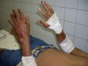 pi-113-motoqueiro-se-choca-com-animal-e-sofre-va-rias-escoriaa-a-es-pelo-corpo48f76f127d678b5fe6aa92fc075510cf