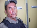 policial agredido