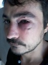 miudo 1