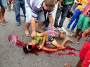adolescente-sangra-pelos-ouvidos-e-nariz-ap-grave-acidente9fa2b88f0e186fd442f14cbb94a835b4