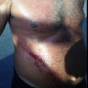 -vitima-ficou-lesionada-apos-a-briga-356083